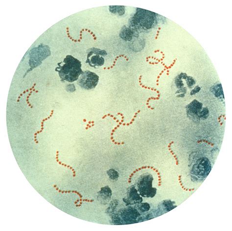 Scarlet Fever Bacteria Shape