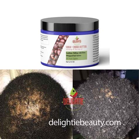 Chebe Hair Growth Butter With Tea Tree Oil Authentic Chebe Powder From