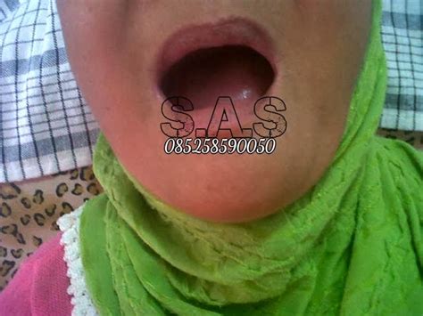 We did not find results for: Gigi Palsu Lepas Pasang Total (Lengkap) Atas Bawah | AHLI ...