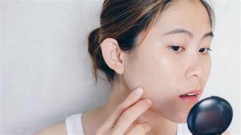 Make Cystic Acne Disappear With These Makeup Hacks
