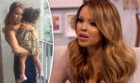 Katie Piper Opens Up On Plans To Tell Daughter Belle About Acid Attack Tv And Radio Showbiz