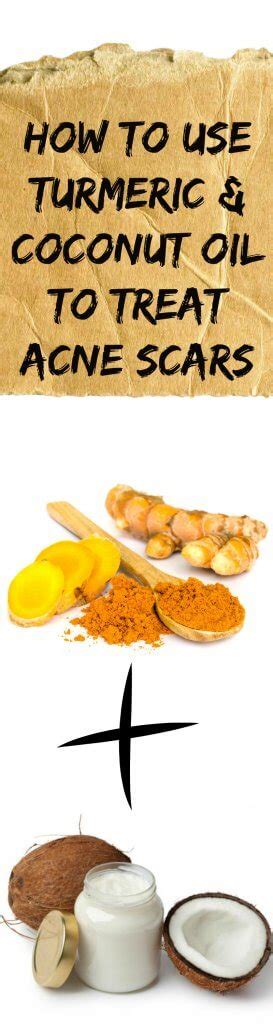 Turmeric And Coconut Oil To Treat Acne Scars