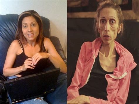 omg see what anorexia did to this beautiful 37 year old actress celebrities nigeria