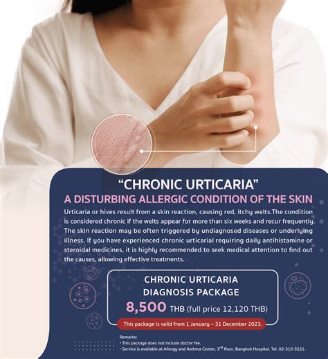 Chronic Urticaria Diagnosis Package Bangkok Hospital