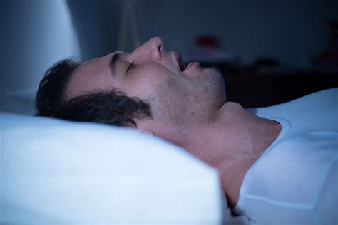 treating sleep apnea without cpap mckinney smiles