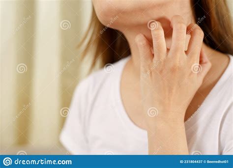 Woman Suffers From Itchy Irritated Skin Due To Covid 19 Stock Image
