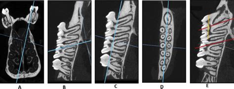 Check spelling or type a new query. A rodent model using skeletal anchorage and low forces for ...