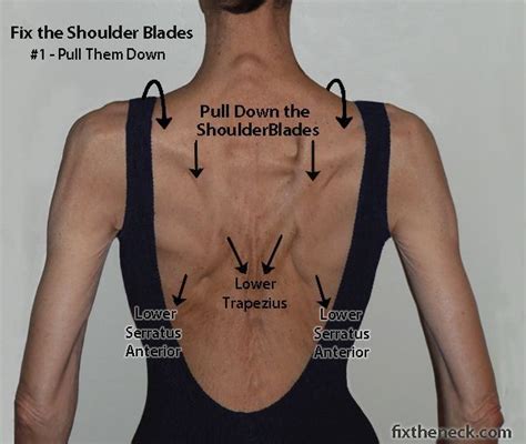 Shoulder pain is a symptom rather than a condition in itself. Overcoming Chronic Neck Pain: Postural Causes and A Unique ...