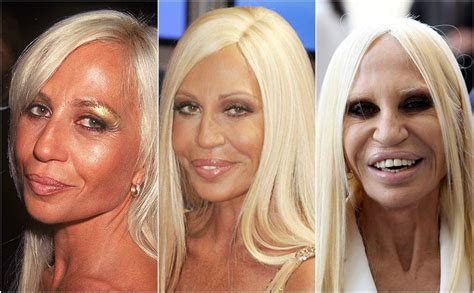 10 Celebrities Who Are Addicted To Plastic Surgery Runnerguru
