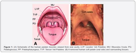Soft Palate And Its Motor Innervation A Brief Review
