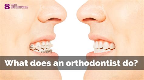 What Does An Orthodontist Do Ewell Orthodontics