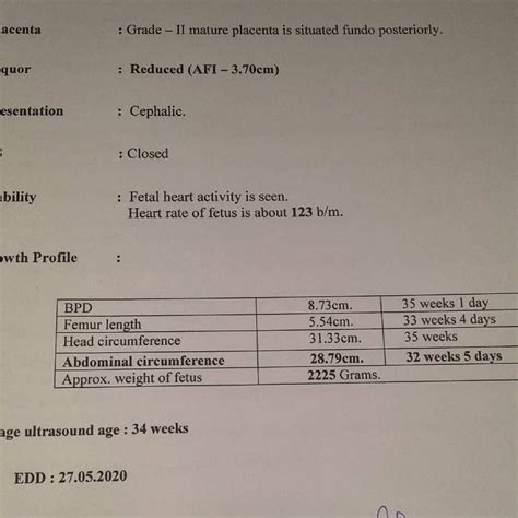 Slsilk How Long For Sulfatrim To Work Benadryl Dosing Chart For 1