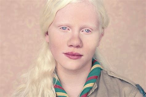 Portrait By Br Albino Girl Albinism Albino Model