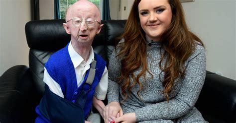 Alan Barnes Disabled Oap Attacked By Mugger Asks For Donations To Stop