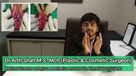 What Is Hymenoplasty Explained By Plastic Surgeon Dr Arth Shah YouTube