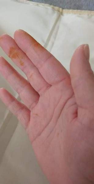 Rust Colored Stains On Hands Overnight Asking List