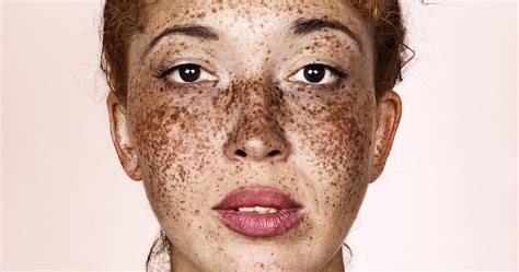 Freckles Brock Elbanks Striking Portraits In Pictures Art And