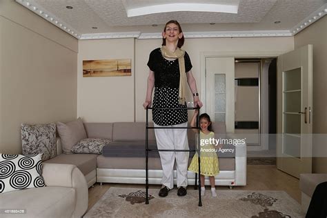 rumeysa gelgi granted as the world s tallest girl with her 2 13 meter news photo getty images