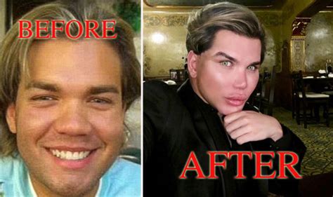 Rodrigo Alves Before And After Pics Human Ken Doll Who Has Had Fifty
