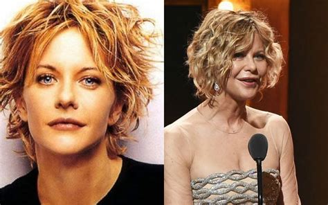 20 Celebrity Before And After Plastic Surgery Disasters Page 5