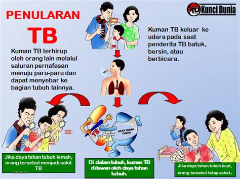 Tips Mudah Menghindari Penularan Penyakit Tbc Berdarah Rencana Baik