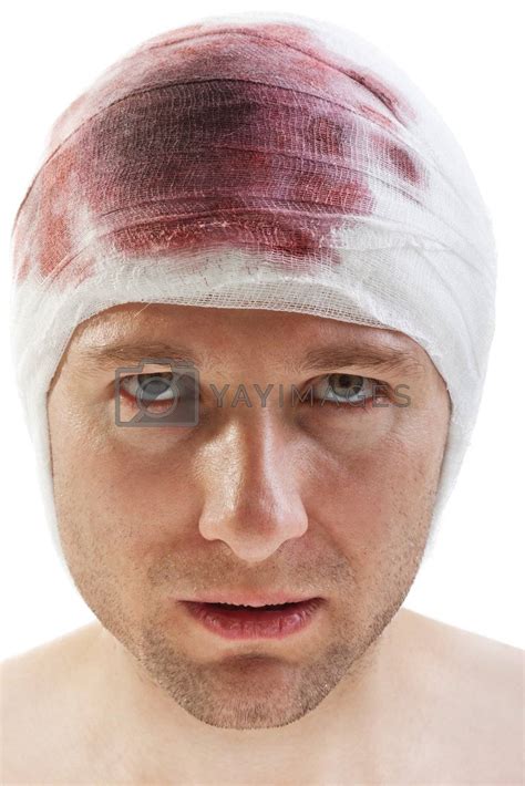 Bandage On Blood Wound Head By Ia64 Vectors And Illustrations With