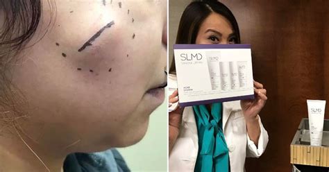 Dr Pimple Popper Is Launching A Skincare Range Slmd Metro News