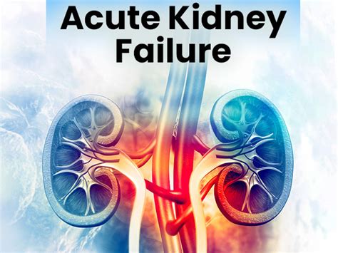 Kidney Failure Pictures