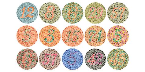 Colour Blindness Symptoms Types Causes And Treatment Santripty