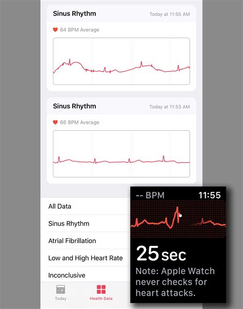 How To Use The Ecg Feature On Apple Watch Series 4 Techconnect