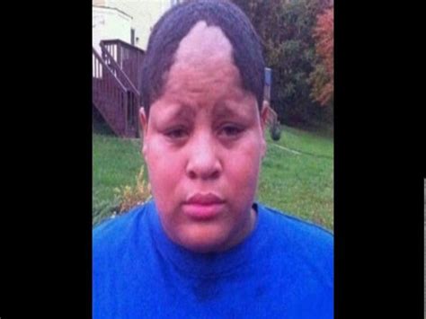 Cool Bad Hairline Check More At Hairstylesformenclubbad Hairline Bad Hairline Cool