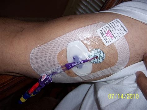 Place aluminum foil or plastic wrap over any work area made of. 17 Best images about Wound Care By Paloma Home Health ...