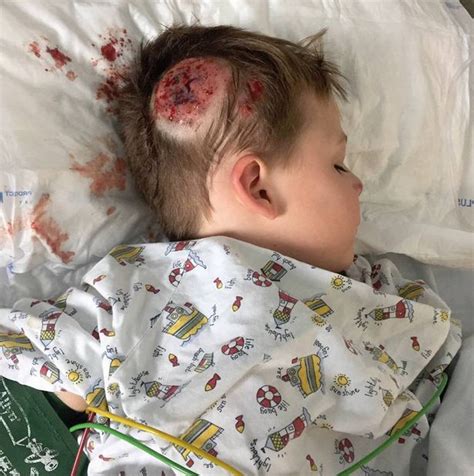 Horrifying Pictures Of Little Boy Who Was Left With Bleeding Lump On
