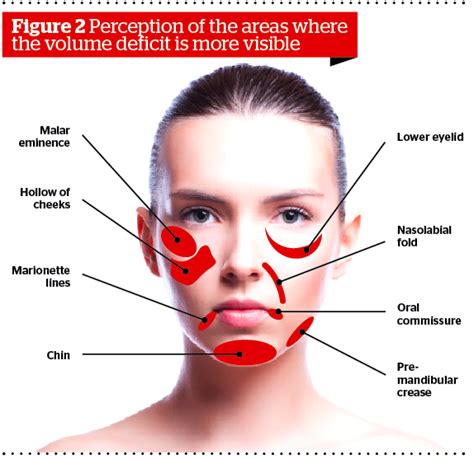 The Invisible Facelift Prime Journal Nasolabial Folds Aesthetic