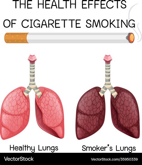 Poster On Health Effects Cigarette Smoking Vector Image