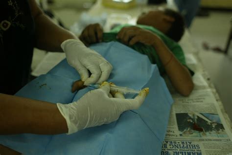 59cc6472 Male Circumcision Taguig Philippines All Rights Flickr