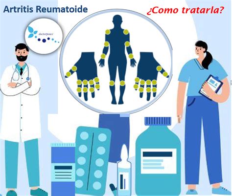 MANEJO DE LA ARTRITIS REUMATOIDE Clínica Reumatológica Dr Ponce