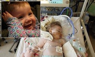 Britain S Babeest Patient To Get Heart Implant Spends First Birthday Fighting For Her Life As