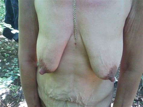 Ugly Homeless Granny In Forest 11 Pics XHamster