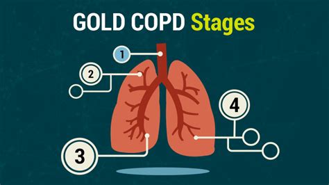Lung Health Institute Gold Copd Stages Copd Stages Copd Copd Symptoms