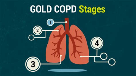 Lung Health Institute GOLD COPD Stages Copd Stages Copd Copd Symptoms