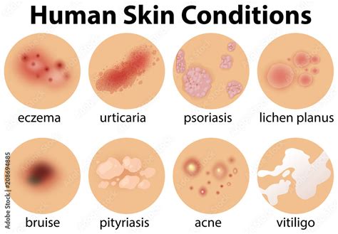 A Set Of Human Skin Conditions Stock Vector Adobe Stock