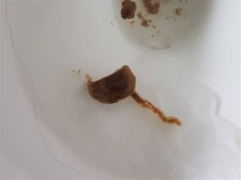 Possible Parasites In Stool Irritable Bowel Syndrome Forums Patient