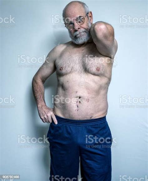 Senior Man With Healing Cancer Tumor Extraction Surgery Incision Scar