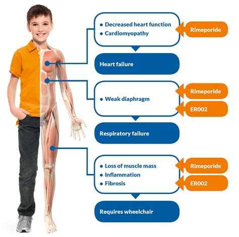 Muscular Dystrophy Symptoms Causes And 02 Risk Factors