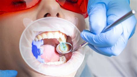 What Is Dental Caries Symptoms Causes And Treatment