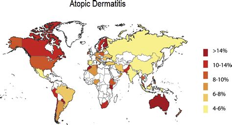 Epidemiology Of Atopic Dermatitis And Atopic March In Children