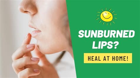 Get Rid Of Sunburned Lips Easily At Home Sunburned Lips How To Get