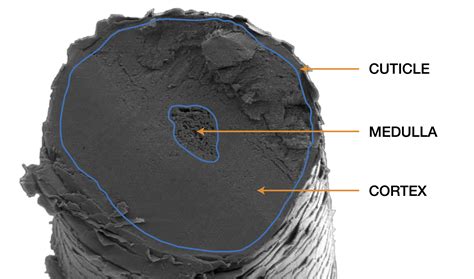 Cross Section Of A Human Hair
