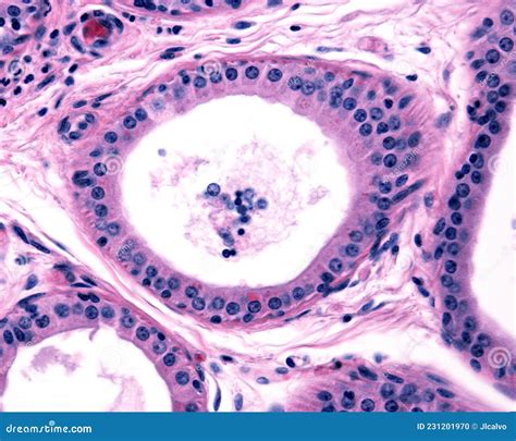 Apocrine Sweat Gland Columnar Epithelium Stock Photo Image Of Eosin